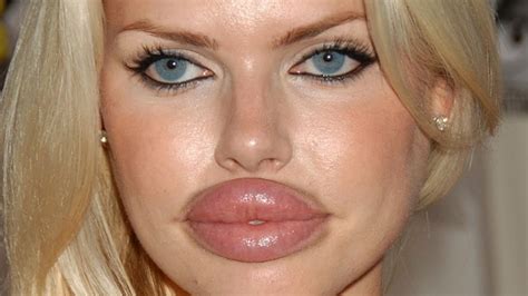 10 worst plastic surgery disasters.